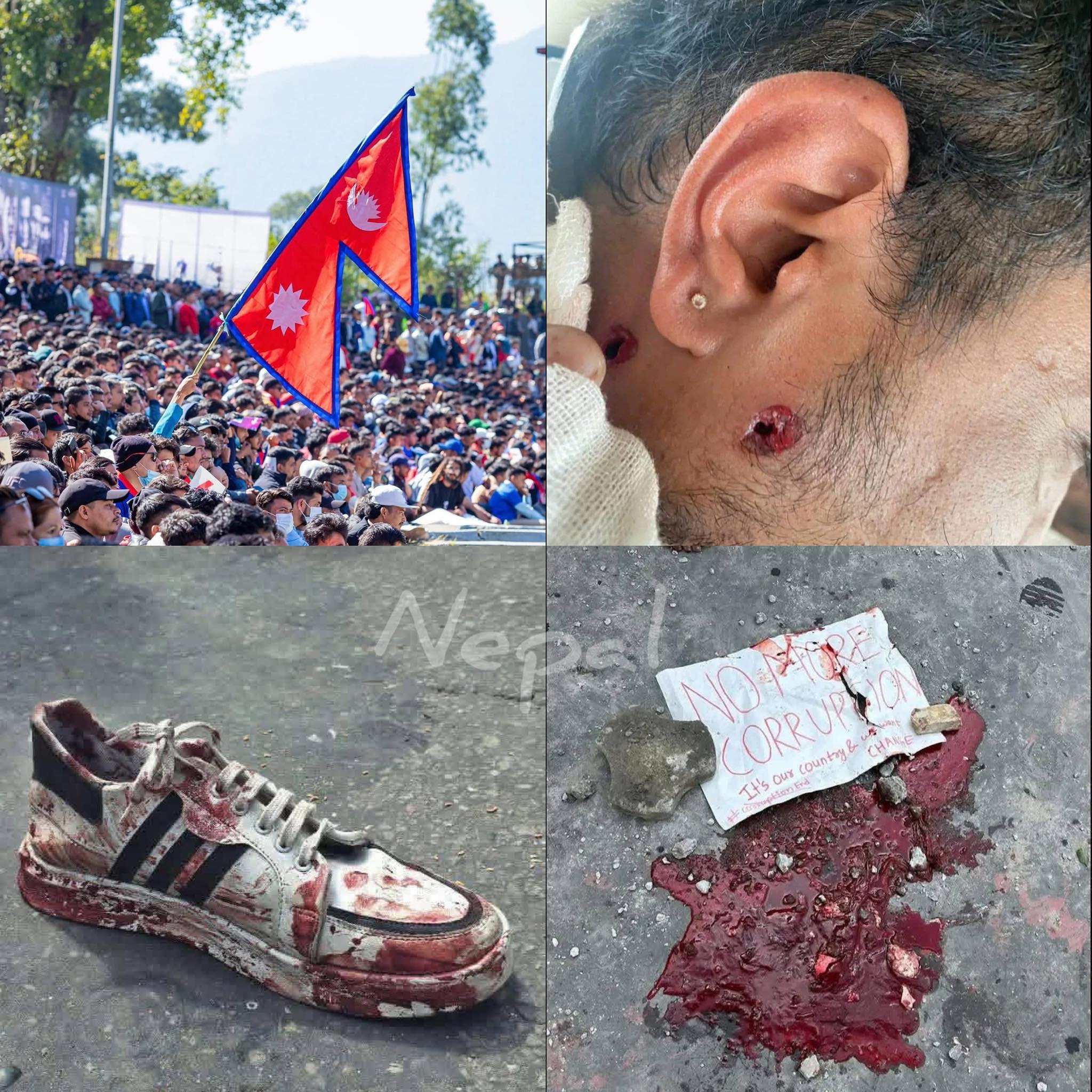 जेन- जी प्रदर्शनमा प्रहरीले गोली चलाउदा १९ जनाको मृत्यु