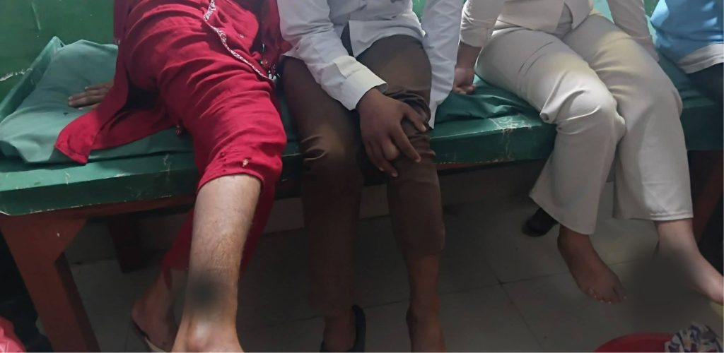 कुकुरको टोकाइबाट कञ्चनपुरमा १६ जना घाइते