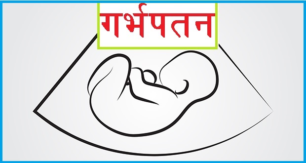 असुरक्षित गर्भपतन : दैनिक औसत २ जना महिलाले ज्यान गुमाउँदै